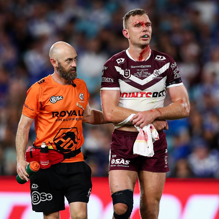 NRL Casualty Ward: Turbo injures shoulder; Bone bruising for Paps